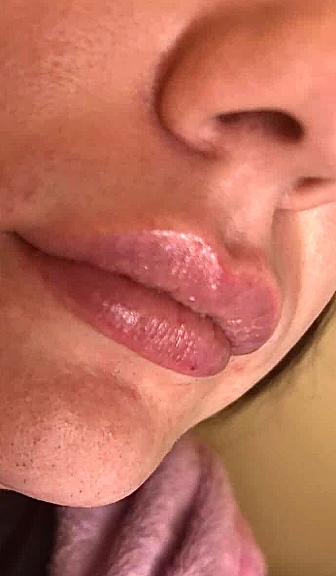 Golden Glow Aesthetics treatment