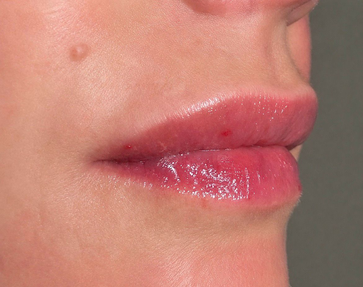 Golden Glow Aesthetics treatment